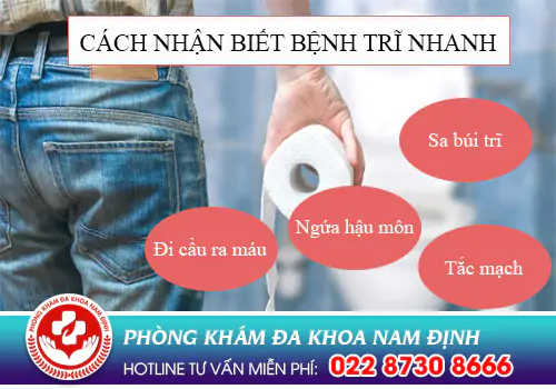 4 Cách nhận biết bệnh trĩ nhanh chóng