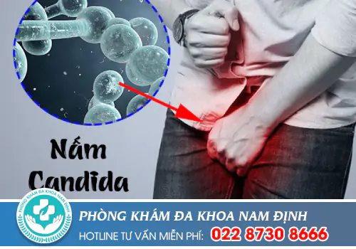 Nấm Candidan ở vùng kín nam giới có nguy hiểm không?